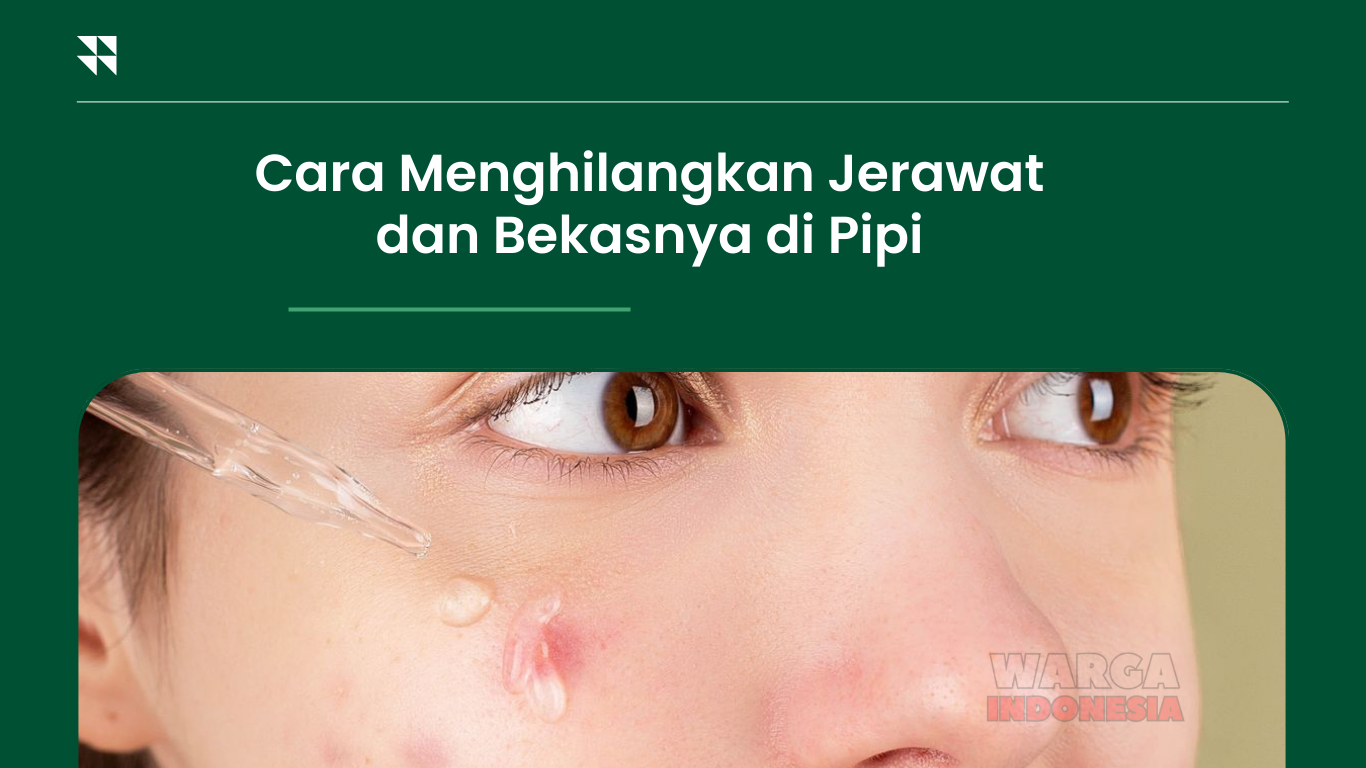 Cara Menghilangkan Jerawat dan Bekasnya di Pipi