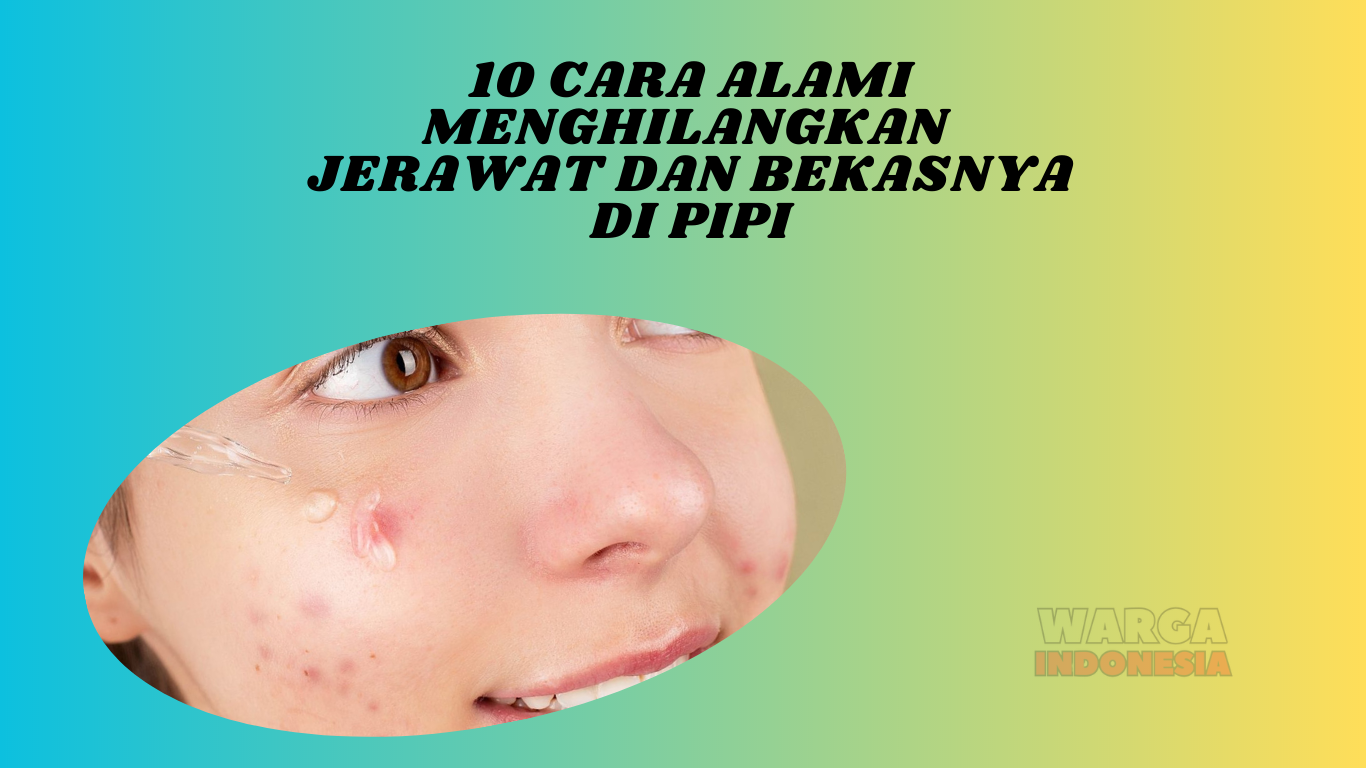 10 Cara Alami Menghilangkan Jerawat dan Bekasnya di Pipi