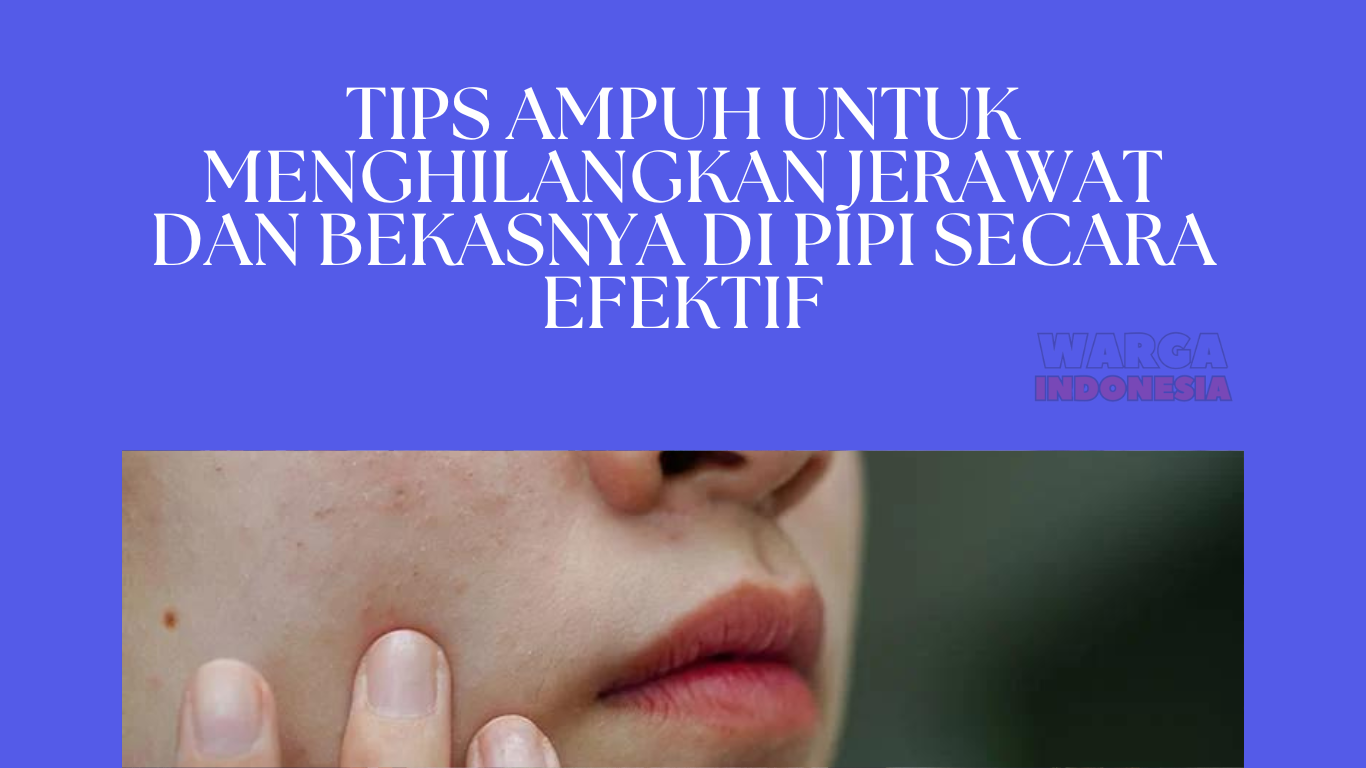 Tips Ampuh untuk Menghilangkan Jerawat dan Bekasnya di Pipi secara Efektif