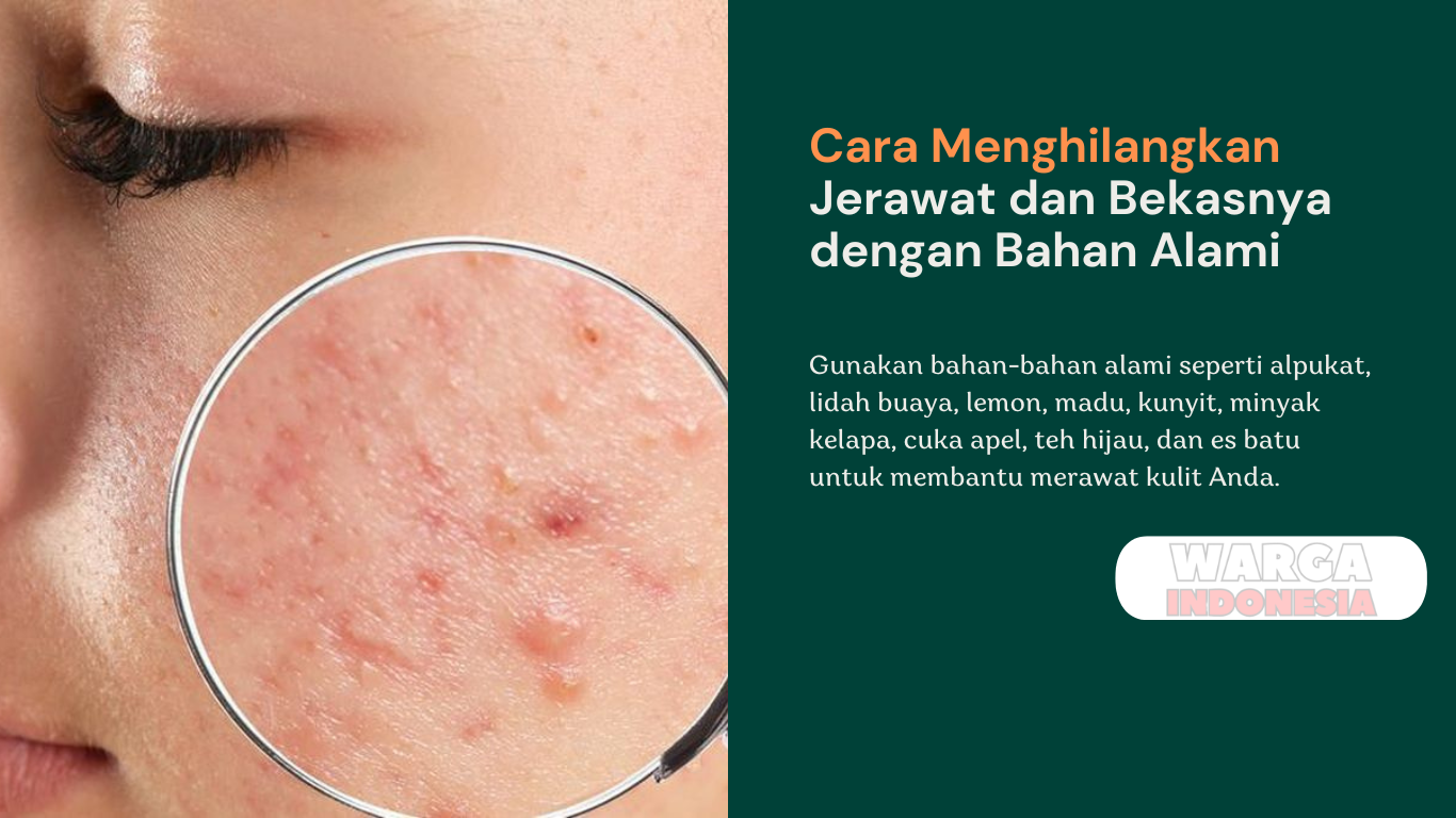 Cara Menghilangkan Jerawat dan Bekasnya dengan Bahan Alami