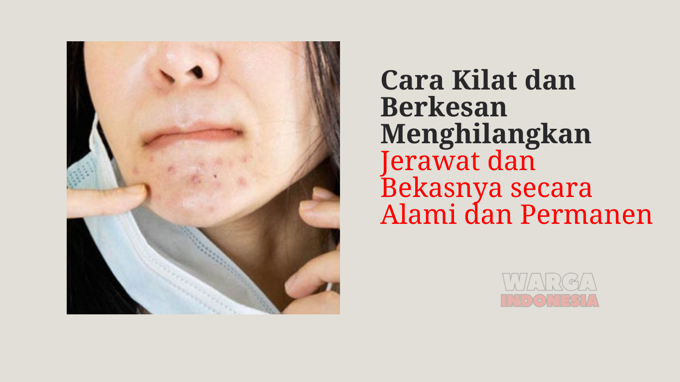 Cara Kilat dan Berkesan Menghilangkan Jerawat dan Bekasnya secara Alami dan Permanen