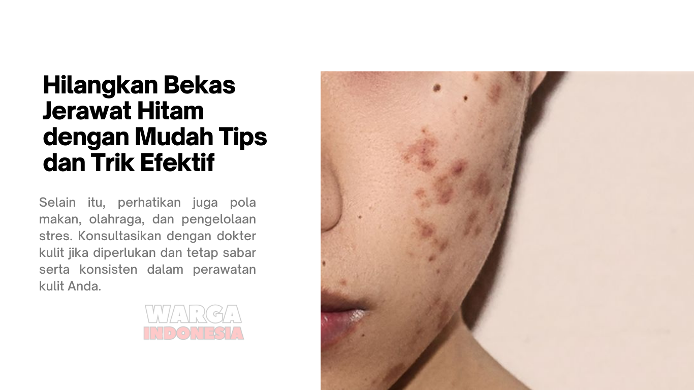 Hilangkan Bekas Jerawat Hitam dengan Mudah Tips dan Trik Efektif