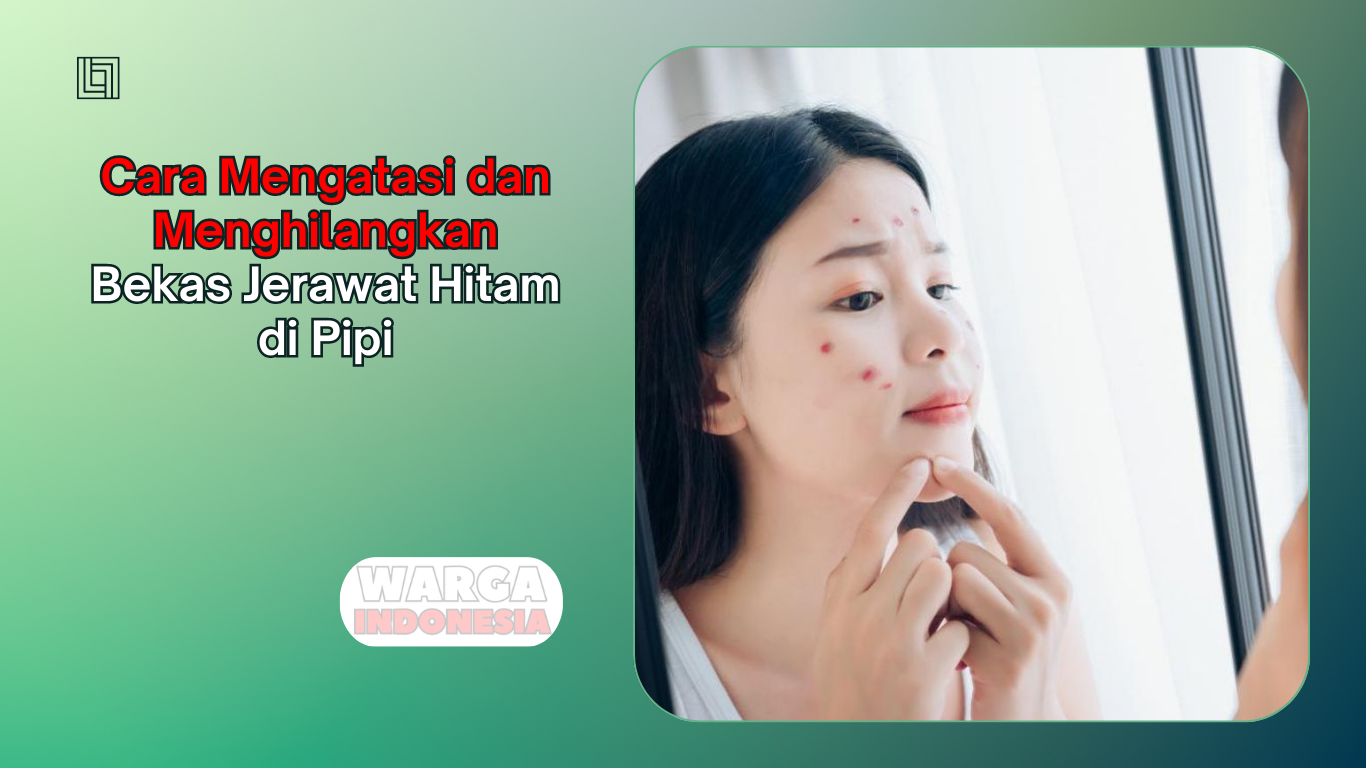 Cara Mengatasi dan Menghilangkan Bekas Jerawat Hitam di Pipi